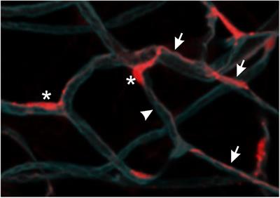 Metabolic Coordination of Pericyte Phenotypes: Therapeutic Implications